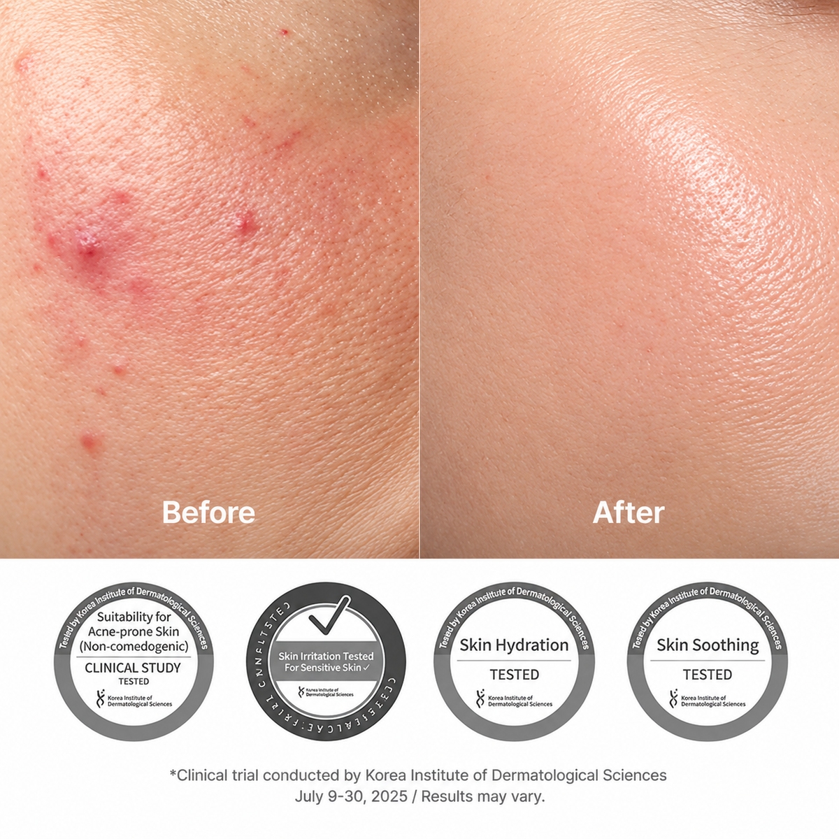 Dr. Althea 345 Relief Cream for Acne-Prone Skin